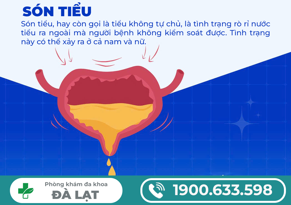 Hình ảnh minh họa